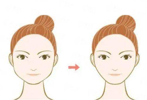 二、在南昌国丹植发做微针植发，流程和体验如何？