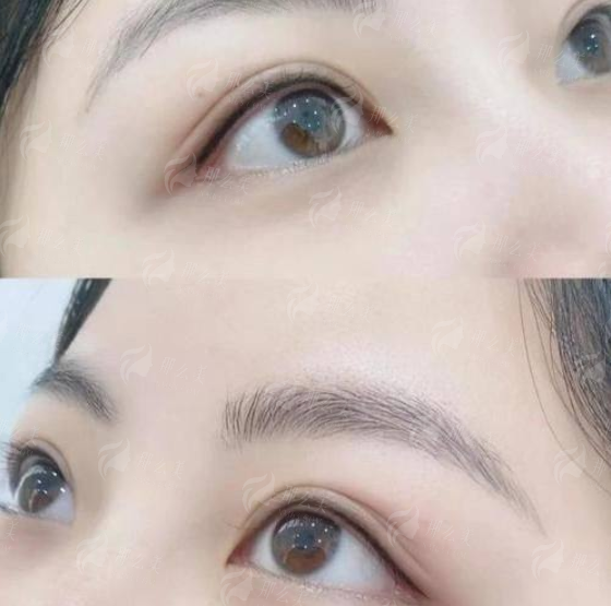 <strong>四、<strong>广州曙光医学美容医院万友望医生隆胸</strong>术后成效与口碑如何？</strong>