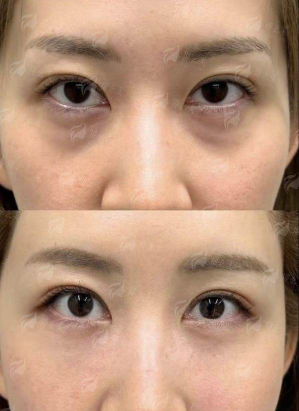 <strong>二、<strong>广州曙光医学美容医院万友望医生隆胸</strong>的价格与方案怎么选？</strong>