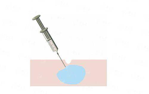 五、德州聚星医美提眉术价格明细与优惠活动