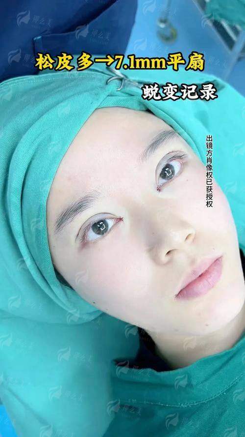 四、上海爱尚丽格杜园园医生眼修复，如何选择与预约？