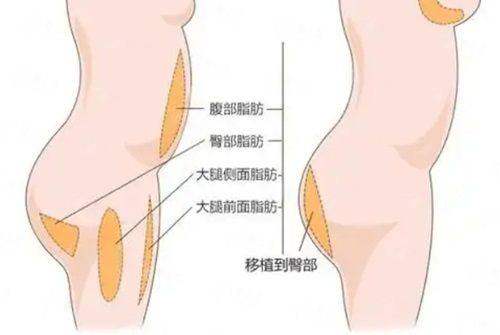二、湖北襄阳伊莱美医疗美容的拉皮技术有何特色？
