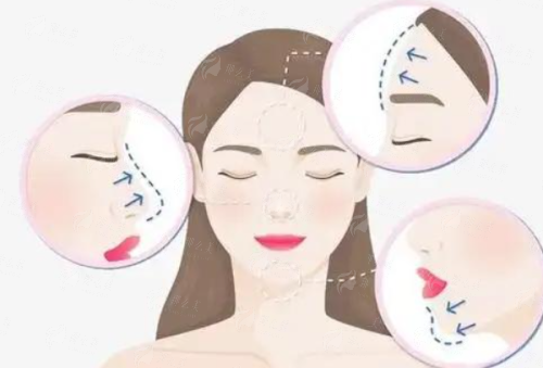 二、上海华美整形除了张朋医生，还有哪些隆鼻骨干医生值得面诊？