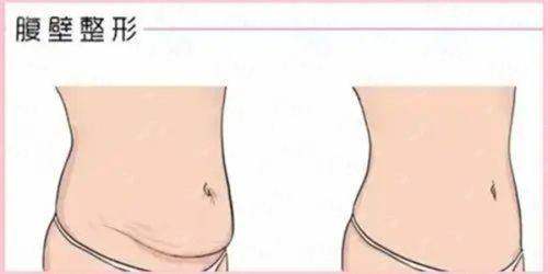 四、广州广大整形医院如何预约与选择？