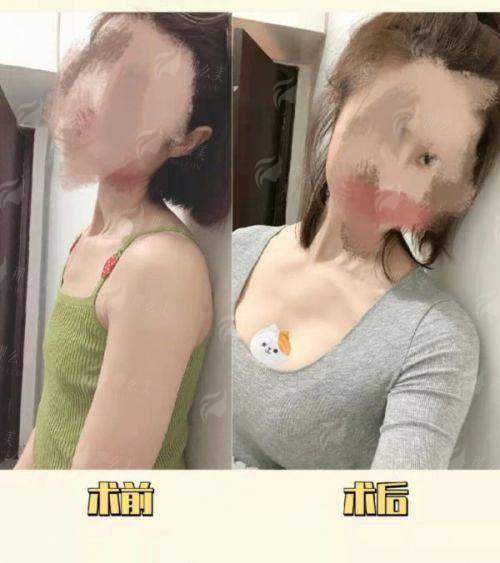 四、如何预约与询问广州焕新颜医疗美容的陈保荣医生隆胸相关服务？