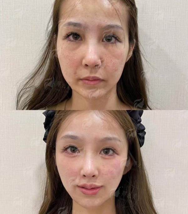 一、曹云飞医生双眼皮信息难觅,为何广州焕新颜医疗美容值得关注?