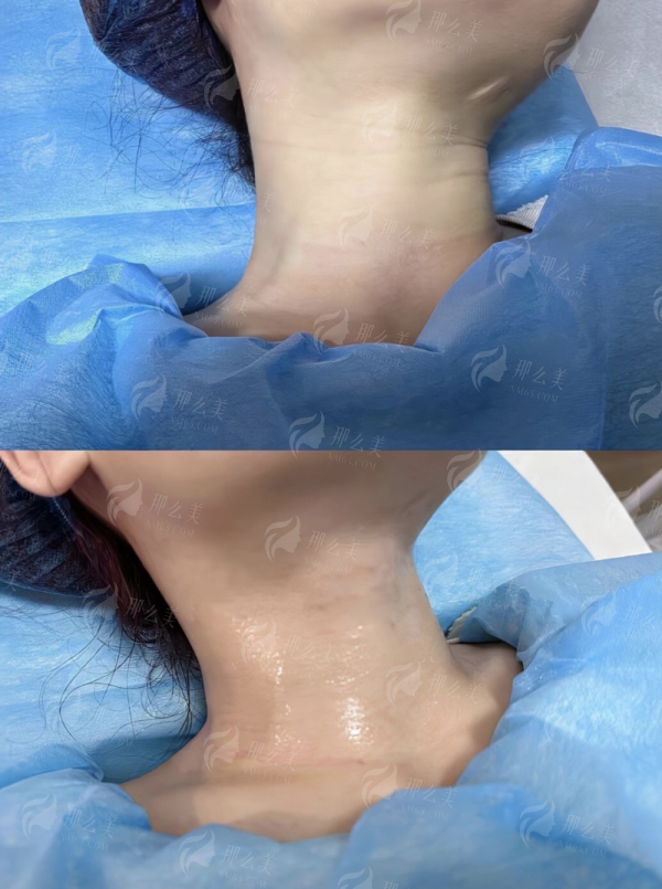 <strong>四、如何预约王晓健医生人中手术?北京蕾士悦容整形多种便捷通道指南</strong>