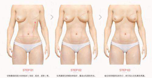 <strong>六、苏州维多利亚美容医院瞿靖医生预约挂号指南</strong>