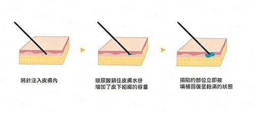<strong style="color:red;">五、苏州维多利亚隆胸术后管理体系</strong>