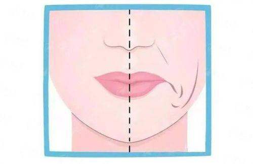 六、选择苏州维多利亚美容医院肋骨隆鼻的优势