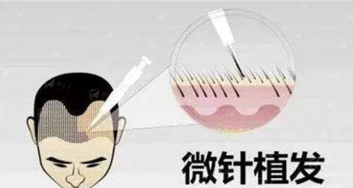 四、包头吴姝华美植发如何选择与预约?