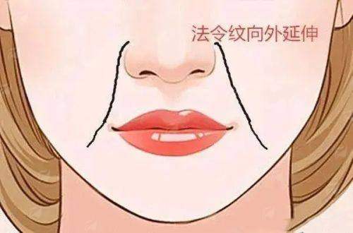 二、苏州维多利亚美容医院阎红医生的双眼皮手术风格