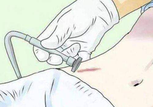 <strong>四、患者真实评价与口碑</strong>