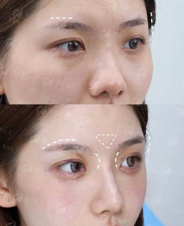 <strong style="color:red;">二、影响苏州维多利亚隆胸价格的核心因素</strong>