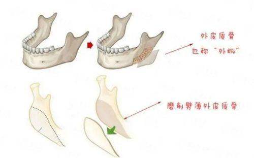 <strong>二、福建福州名韩医疗美容的双眼皮技术好吗？</strong>