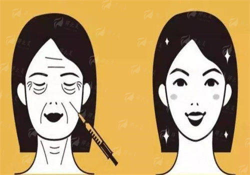 连云港媚眼整形鼻头缩小手术多少钱？附真实案例推荐与预约方式，新颜智尚小程序可约