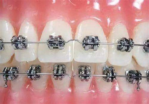 新颜智尚预约实鼎口腔隐形矫正，查看医生信息、价格了解及到院路线