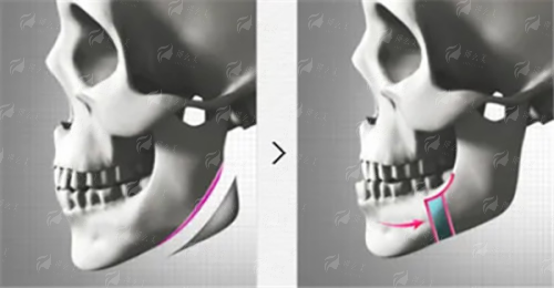 孟强院长拉皮手术价格与预约方式？沈阳腾采新颜智尚小程序一键搞定