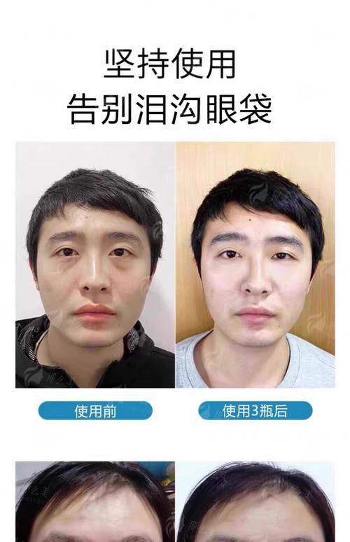 四、厦门思明美仑美奂医疗美容如何选择与预约?