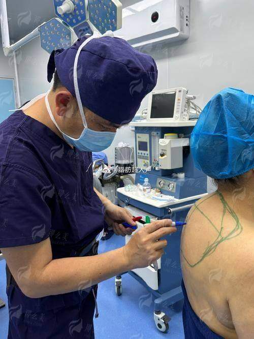 四、连云港吸脂好医院有哪些?一站式预约指南