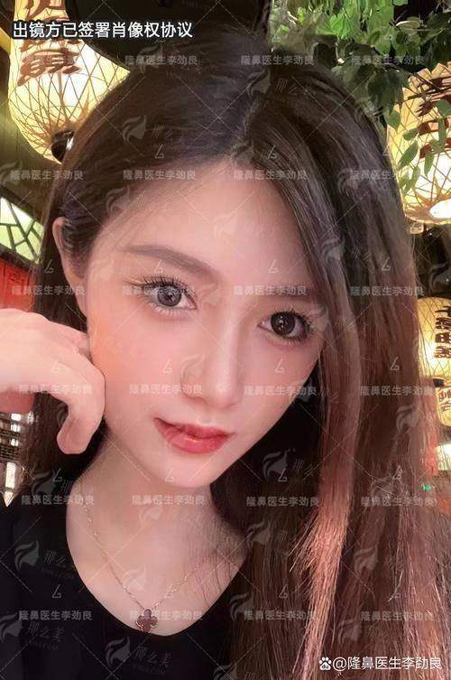 想预约秦皇岛念奴娇隆鼻？新颜智尚小程序便捷预约，附医院介绍与特色技术