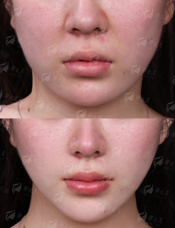 一、北京联合丽格第二医疗美容医院的面部抗衰理念是什么?