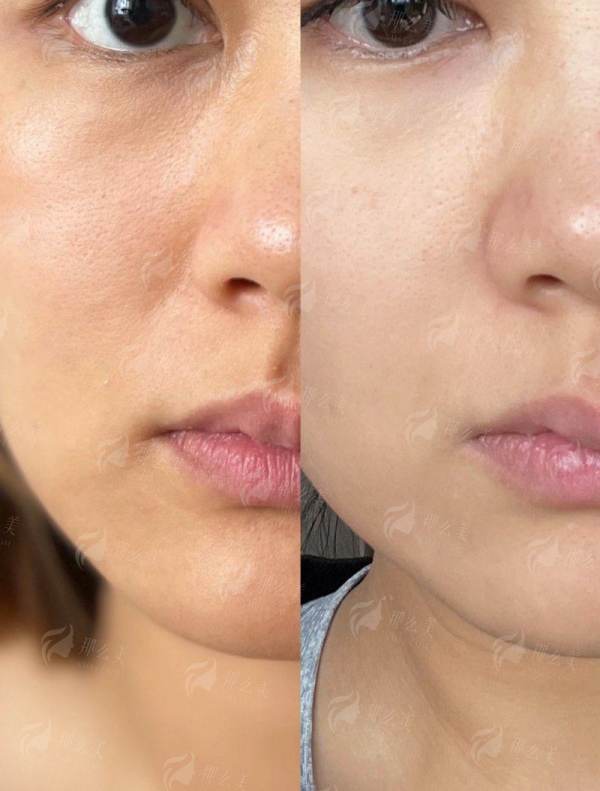 二、北京联合丽格第二医疗美容医院的面部抗衰有哪些特色技术?