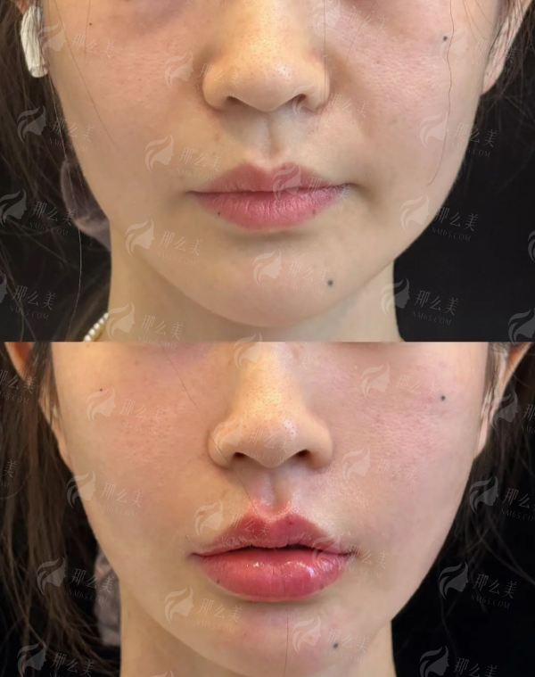 三、北京联合丽格第二医疗美容医院的面部抗衰价格与医生如何?