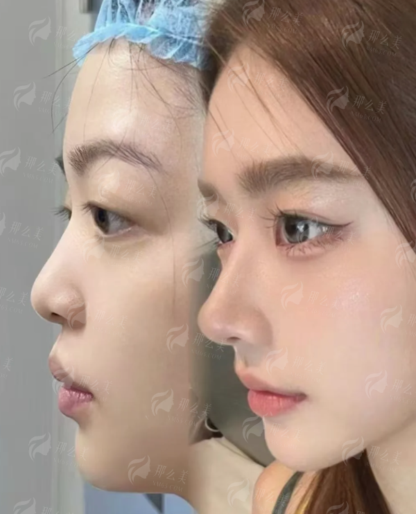 四、北京联合丽格第二医疗美容医院如何预约与面诊?