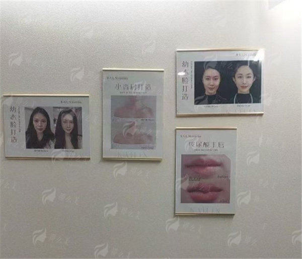 新颜智尚小程序一键预约！德州凯琳医美口碑如何？翟春雷医生眼综合案例+24小时预约电话