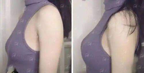 二、锦州医疗美容医院的隆胸医生团队专精吗？