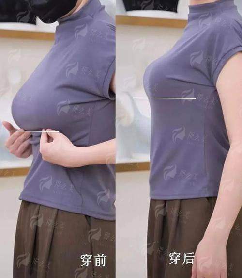 三、在锦州做隆胸，选择锦州医疗美容医院有什么优势？