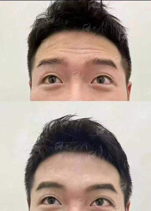 二、在锦州做除皱，锦州医疗美容医院的价格贵不贵？