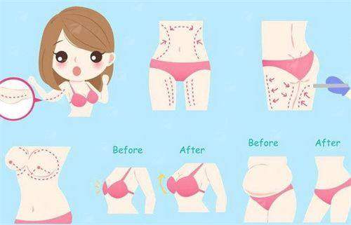 二、廊坊医大（知颜）医疗美容做手臂吸脂，骨干医生团队实力如何？