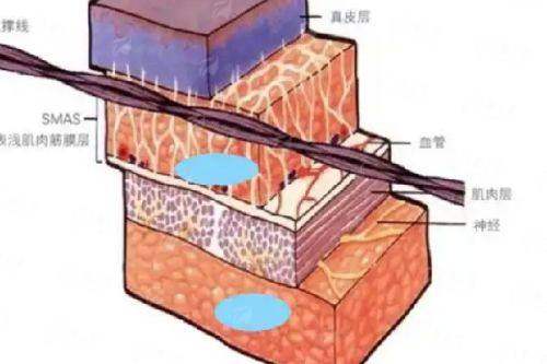 四、益阳明瑞医疗美容的拉皮手术如何选择与预约？