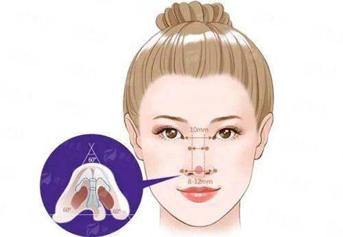 济南美莲假体隆鼻医生谁做得好？新颜智尚一键预约，对比案例与用户反馈