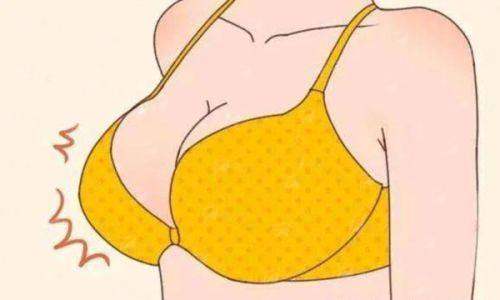 一、海南三亚瑞希医疗美容的闫小宇医生假体隆胸怎么样?