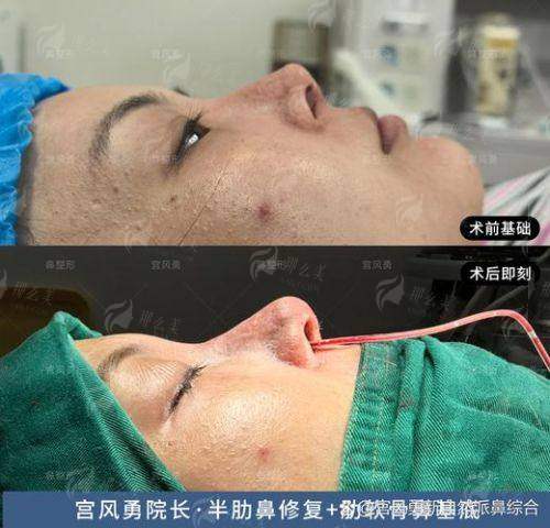 新疆奎屯优兰卡医美鼻修复怎么样？看真实用户反馈与医院介绍，新颜智尚预约