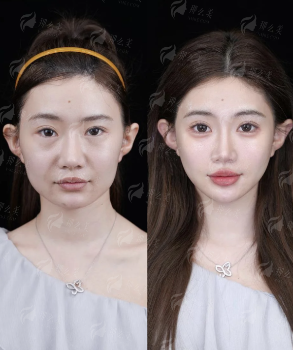 郭红霞医生在嘉兴兮颜棠做抗衰口碑如何？预约方式与案例看这里