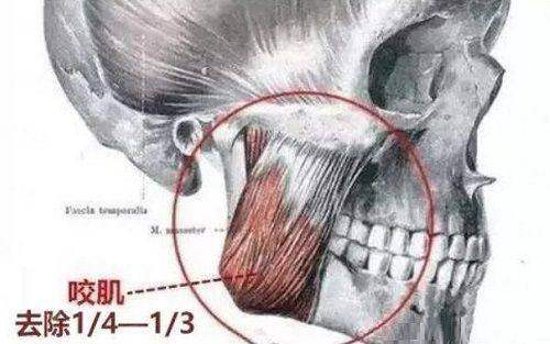 <strong>三、<strong>在云南昆明韩辰医疗美容医院做隆胸，价格与价值怎么看？</strong></strong>