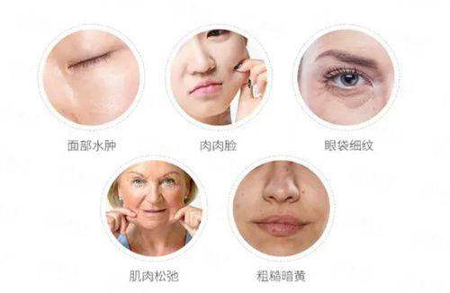 <strong>三、<strong>在河南新乡弈诺美医疗美容做线提升的价格与流程是怎样的？</strong></strong>