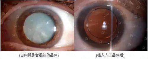 <strong>四、<strong>如何预约浙江金华丽都整形的双眼皮面诊？</strong></strong>