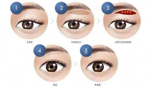 <strong>三、关注价格与价值,长沙美莱整形的隆胸投资怎么看?</strong>