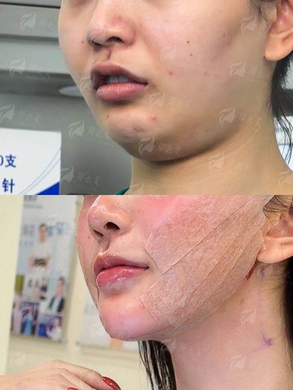 <strong>三、想找北京齐敏医生做拉皮，口碑和服务流程体验如何？</strong>