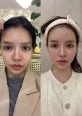 <strong>二、浙江金华丽都整形的祛眼袋医生团队好吗？</strong>