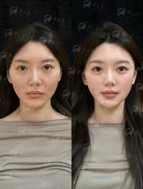 <strong>二、<strong>河南新乡弈诺美医疗美容的线提升医生团队实力如何？</strong></strong>