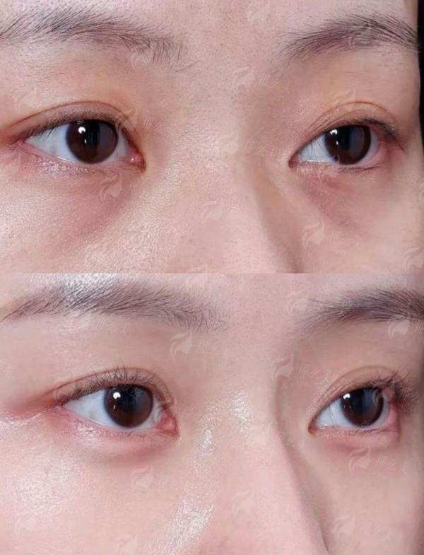 张正文耳再造费用5 - 12万，新颜智尚小程序一键预约，附医院地址与案例