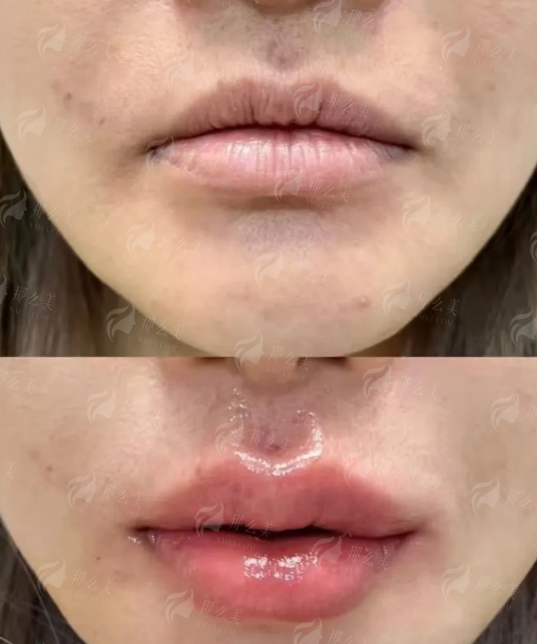 <strong>二、山东威海华怡整形隆胸的医生团队实力如何?</strong>