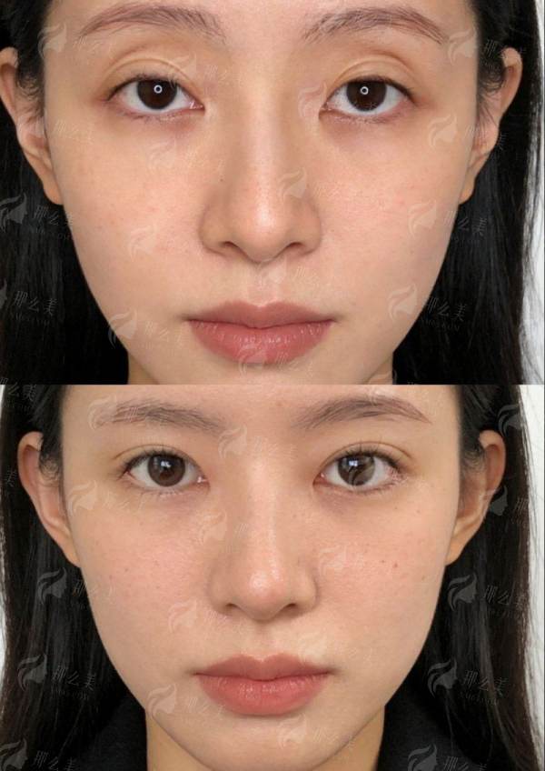 <strong>二、云南昆明韩辰医疗美容医院的薛芝蓝医生私密技术有何特色？</strong>