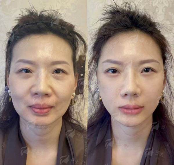 <strong>四、如何预约长沙美莱整形的拉皮手术面诊？医院信息一览</strong>